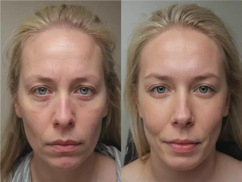 DeepSleep Bliss Review 2